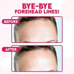 Bloomora Forehead Wrinkle Patches, Hyaluronic Acid, Peptides & Collagen (16pcs)