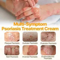 1 Pack Crema Para Dermatitis Eczema Psoriasis Para Comezon Picazon Ronchas En La