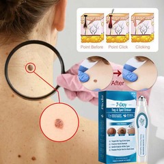Tag & Spot Eraser Mole Skin Tags Removal Tool Eraser Pen Painless Long-Lasting