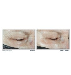 RoC MULTI CORREXION Hydrate + Plump Eye Cream Peptides Hyaluronic Acid 0.5 oz