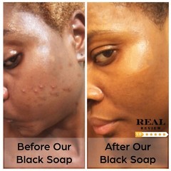 Raw African Black Soap Fresh Premium Quality Unrefined From Ghana Wholesale Bulk