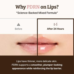 Advanced PDRN Rejuvenating Lip Serum – Hydrating Lip Balm with Lipozip PDRN f…