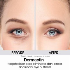 Gentle Anti-Aging Eyelid Cream – 1 oz. for Sensitive Skin with Citric Acid