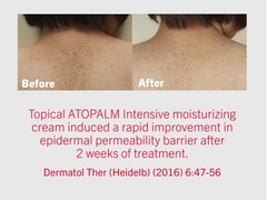 ATOPALM Intensive Moisturizing Cream for Dry & Sensitive Skin, Face Moisturizer,