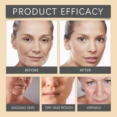 3-Bee Venom Cream Anti-aging Cream Remove Wrinkles quality Lines Tightening/L…