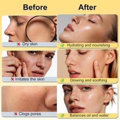 Skin Care Set,6Pcs Women Teen Glass Skincare w/Korean Rice Extract,Hydrate Gl…