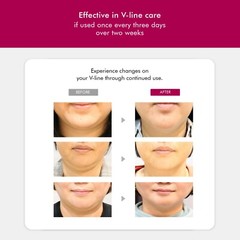 Face Slimming Double Chin Reducing Strap V Line Lifting Sagging Eliminates Belt