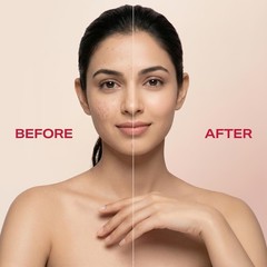Spinz BB Tinted Serum with 5% Nia-Butin Complex Brightens & Evens Skin Tone 30ml