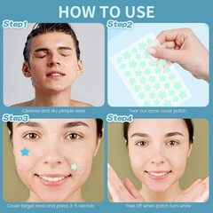 REDANHA 200 Count Star Pimple Patches for 1 (Pack of 200), The Stars