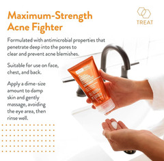 Tratamiento De Hombres Para Quitar El Acne Combinacion Potente Crema