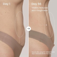 GET-DREAMY Overnight Toning Whip – Cellulite Cream & Skin Tightening Support …