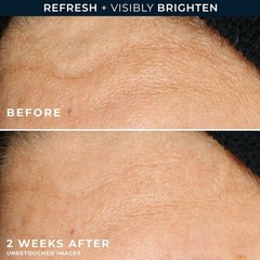 Roc Multi Correxion Revive + Glow Gel Vitamin C Cleanser, Face Wash, Facial Clea