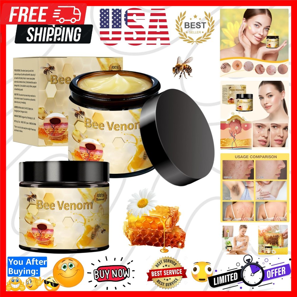 Bee Venom Treatment, New Professional Bee Venom Repair Cream,Bee Venom Moistu…