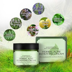 Natural Acne Removal Cream for Oily & Combination Skin | Clears Pimples & Pores