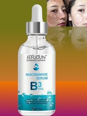 Niacinamide 10% Facial Serum Skin Brightening Dark Spots Eraser, 30ml [USA Stock