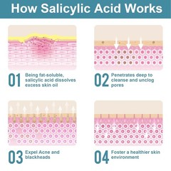 Salicylic Acid Powder (4.58 oz/130 g), Ultra Pure Cosmetic Grade Original…