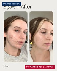 Topicals Faded Brightening and Clearing Serum | Reduces Discoloration, Post-Blem