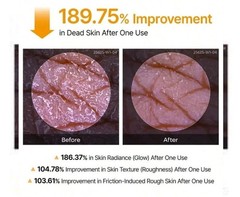 [US Seller] Dr.Melaxin Peel Shot Exfoliating Kojic Acid Tumeric Spray 200ml