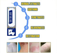 SKIN OINTMENT BODY PSORIASIS DERMATITIS ECZEMA NATURAL TREATMENT CREAM 15G