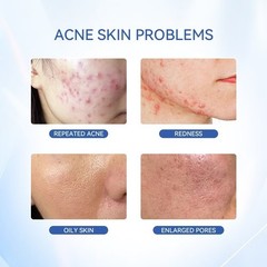 NEW Dr.Leo Acne Essence Salicylic Acid Anti-acne Serum Lighten Acne Scars acne