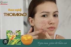 Kem Nghe Thorakao Curcuma Cream Product of Lan Hao 7g