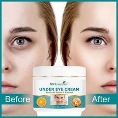 She Essentials Under Eye Cream For Dark Circles 50g P217