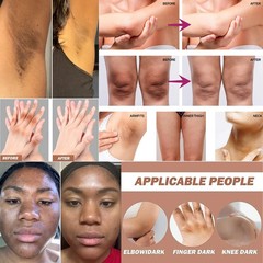 Dark Skin knuckle Whitening lightening Kojic acid Brightening CREAM 15g Unisex