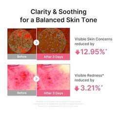 medicube PDRN Pink Peptide Serum with Salmon DNA | Ultra Light Hydrating Serum w