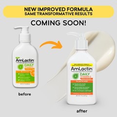 AmLactin Daily Vitamin C Lotion – Brightening Body 7.9 Fl Oz (Pack of 1)