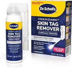 Dr. Scholl&rsquo;s Freeze Away Skin Tag Remover – The First FDA Cleared, at Home Skin