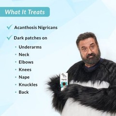 Fixderma Nigrifix cream for Acanthosis Nigricans | For Dark Body Parts