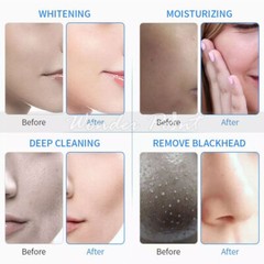 3Bottles Aqua Hydra Peeling Solution Hydro Serum for Dermabrasion Facial Machine