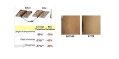120 ML – BIOPEPTIDE™ CL IRON OUT STRETCH MARKS & WRINKLES