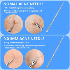 Blackhead Remover Comedone Extractor Kit 5 Pieces Stainless Steel Pimple Acne