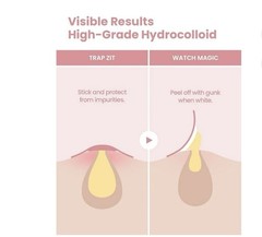 GLAM UP Spotless Smart Patch Hydrocolloid Acne Patches Waterproof Matte 36 ct