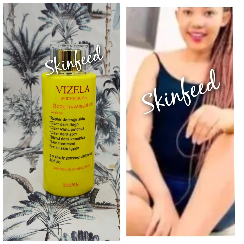 1 Piece Vizela Whitening Face & Body Treatment Oil Ready For Shipping