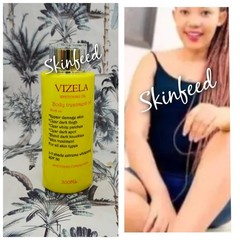 1 Piece Vizela Whitening Face & Body Treatment Oil Ready For Shipping
