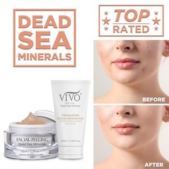 Vivo Per Lei Dead Sea Mineral Facial Peeling Gel Skin Exfoliating Facial Scrub