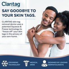 Effective Skin Tag Remover – Cryogenic Freeze-Off – Smooth Skin in 7-14 Days