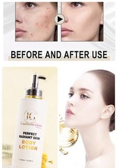 Perfect Radiant Skin Body Lotion glossy’s Skin. Remove Stretch Marks And Scars