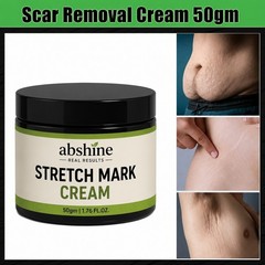 Best Scar Removal-Cream for Old-Scars Stretch Mark Removal Cream 50g