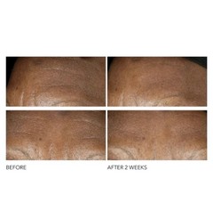 NEW Dr Dennis Gross Advanced Retinol + Ferulic Intense Wrinkle Cream 2 Oz/ 60mL