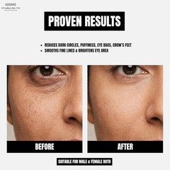 ADONIS E GEL Under Eye Gel 15g Daily Eye Care for Men & Women