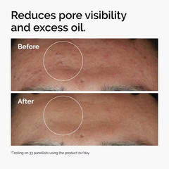 The Ordinary Niacinamide 10% + Zinc 1% 1 fl oz Oil-Free Vegan Serum