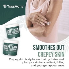 2 X Treeactiv Crepey Skin Repair Treatment, 8Oz, Firming Crepe Skin Cream