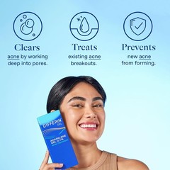 Acne Treatment Gel, 30 Day Supply, Retinoid Treatment for Face with 0.1% Adapale