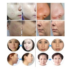 7Colors BIO PDT LED Light Photon Therapy Facial Skin Rejuvenation Beauty Machine