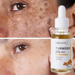 Turmeric Freckle Whitening Serum Curcumin Oil Face Brighten Fade Dark Spot Remov