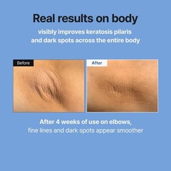 MEDITHERAPY Retinal Skin Booster Serum | Retinaldehyde new