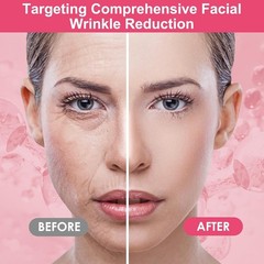 16 PCS Reusable Face Wrinkle Patches Kit | Face Patches for Wrinkles Overnight |